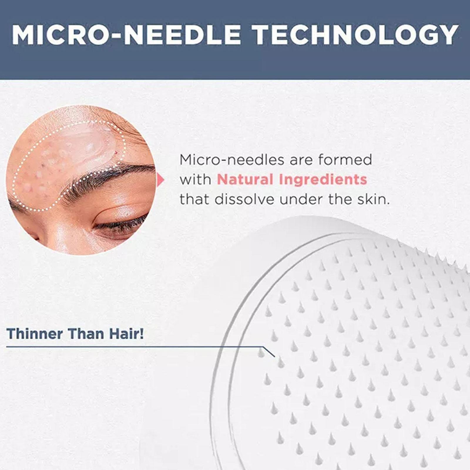 0.2mm Micro-needle Eye Patch M - Sheet Mask Collagen บทวิจารณ์และราคา